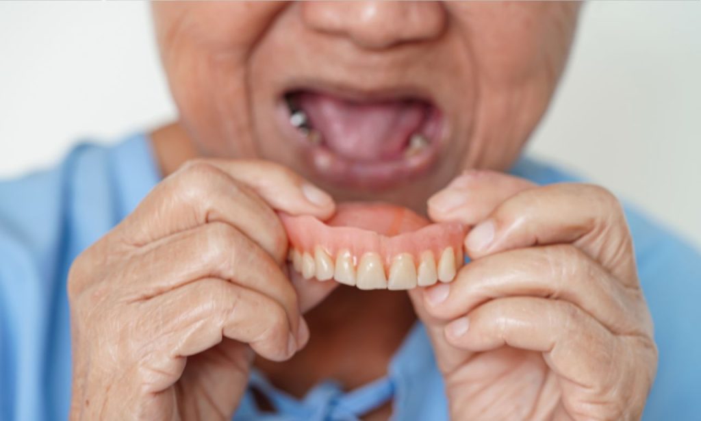 Why Do People Get Dentures?